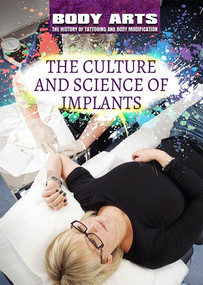 The Culture and Science of Implants - 9781508180647 by Monique Vescia, 9781508180647