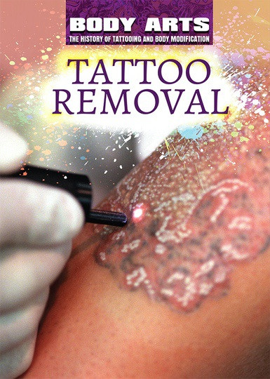 Tattoo Removal - 9781508180791 by Nicholas Faulkner, Frank Spalding, 9781508180791