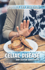 Celiac Disease and Gluten Sensitivity by Michelle Denton, 9781534563735