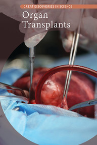 Organ Transplants - 9781502643797 by Cathleen Small, 9781502643797