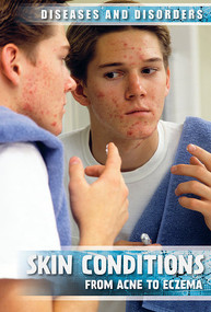 Skin Conditions (From Acne to Eczema) - 9781534564800 by Donna Reynolds, 9781534564800