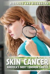 Skin Cancer (America's Most Common Cancer) - 9781534564893 by Peter Kurch, 9781534564893
