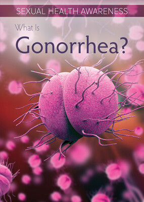 What Is Gonorrhea? by Sadie Silva, 9781499472240