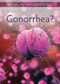 What Is Gonorrhea? by Sadie Silva, 9781499472240