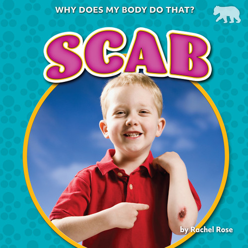 Scab - 9798885093385 by Rachel Rose, 9798885093385