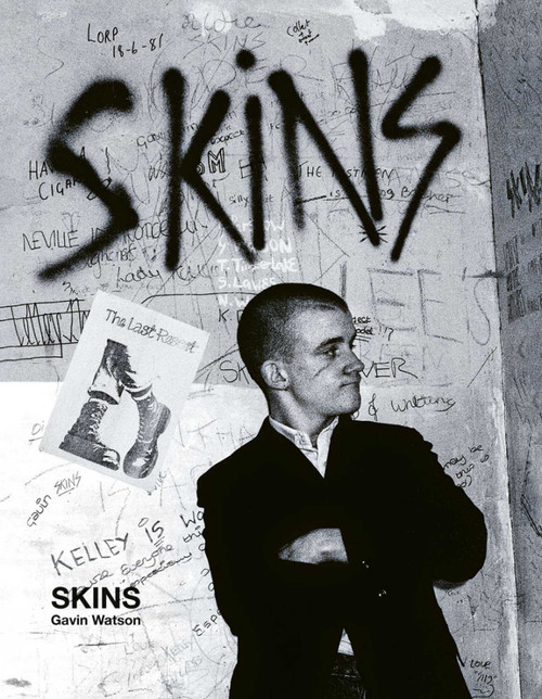 Skins (Gavin Watson) by Gavin Watson, 9781788842167