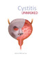 Cystitis Unmasked by James Malone-Lee, 9781910079638