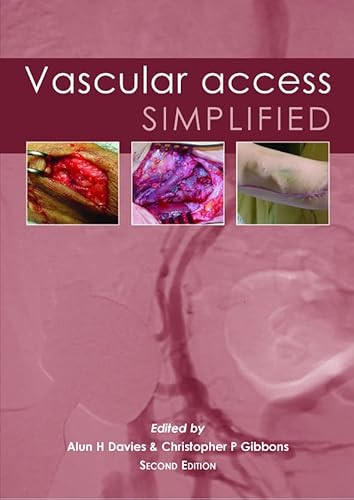 Vascular Access Simplified; second edition by Alun H Davies, Christopher P Gibbons, 9781903378526