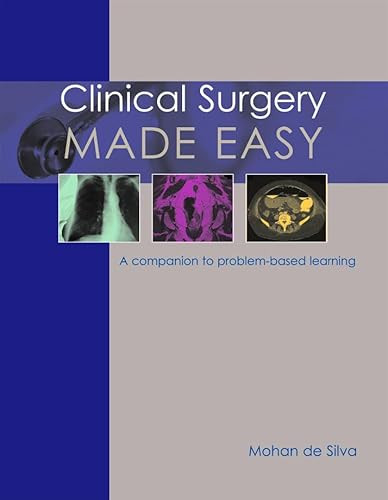 Clinical Surgery Made Easy (A companion to problem-based learning) by Mohan de Silva, 9781903378656