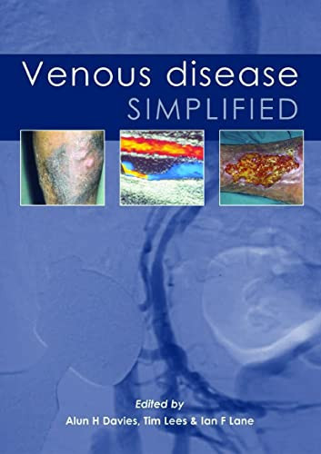 Venous Disease Simplified by Alun H Davies, Ian Lane, Tim Lees, 9781903378250