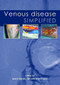 Venous Disease Simplified by Alun H Davies, Ian Lane, Tim Lees, 9781903378250