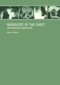 Radiology of the Chest and Related Conditions by F W Wright, 9781138464933