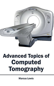 Advanced Topics of Computed Tomography by Marcus Lewis, 9781632410221