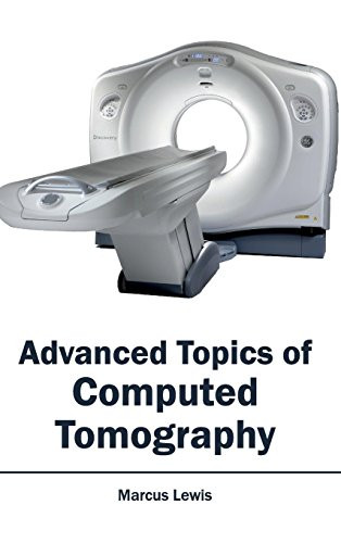 Advanced Topics of Computed Tomography by Marcus Lewis, 9781632410221