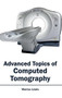 Advanced Topics of Computed Tomography by Marcus Lewis, 9781632410221