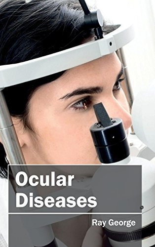 Ocular Diseases by Ray George, 9781632413031