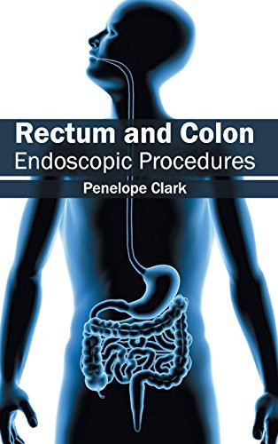 Rectum and Colon: Endoscopic Procedures by Penelope Clark, 9781632413376