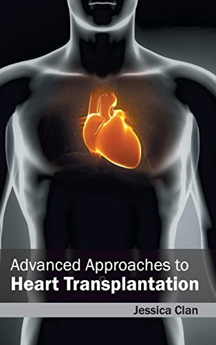 Advanced Approaches to Heart Transplantation by Jessica Clan, 9781632420206