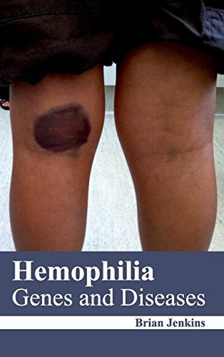 Hemophilia: Genes and Diseases by Brian Jenkins, 9781632422279