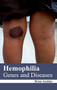 Hemophilia: Genes and Diseases by Brian Jenkins, 9781632422279