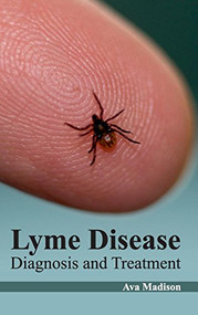 Lyme Disease: Diagnosis and Treatment by Ava Madison, 9781632422620