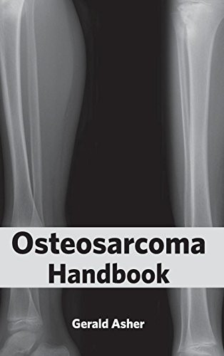 Osteosarcoma Handbook by Gerald Asher, 9781632423078