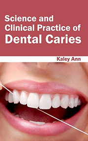 Science and Clinical Practice of Dental Caries by Kaley Ann, 9781632423603