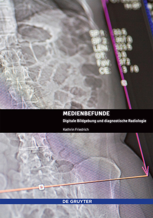 Medienbefunde (Digitale Bildgebung und diagnostische Radiologie) (German Edition) by Kathrin Friedrich, 9783110560053