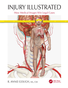 Injury Illustrated (How Medical Images Win Legal Cases) - 9780367615338 by R. Annie Gough, 9780367615338