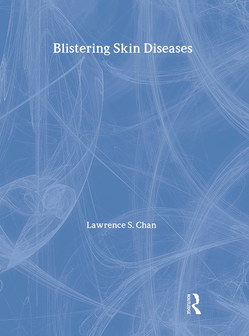 Blistering Skin Diseases by Lawrence Chan, 9781840761757