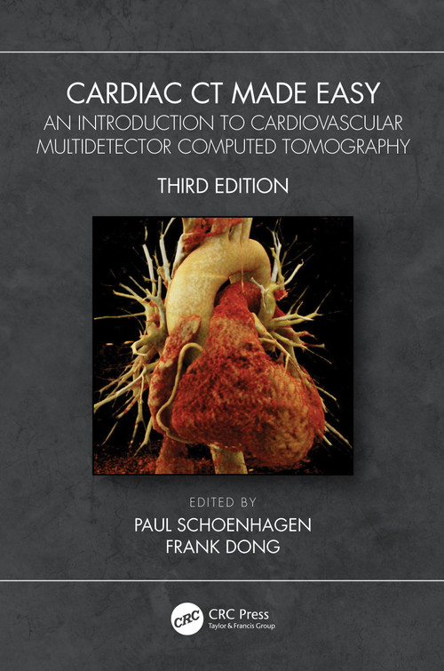 Cardiac CT Made Easy (An Introduction to Cardiovascular Multidetector Computed Tomography) by Paul Schoenhagen, Frank Dong, 9780367721473
