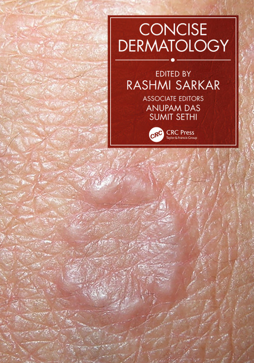 Concise Dermatology by Rashmi Sarkar, 9780367533625