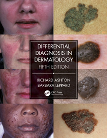Differential Diagnosis in Dermatology by Richard Ashton, Barbara Leppard, 9780367085971
