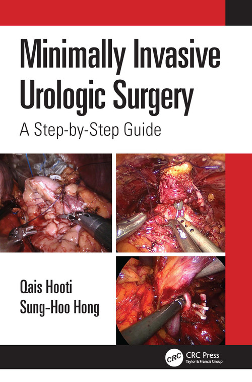 Minimally Invasive Urologic Surgery (A Step-by-Step Guide) by Qais Hooti, Sung-Hoo Hong, 9781032257105