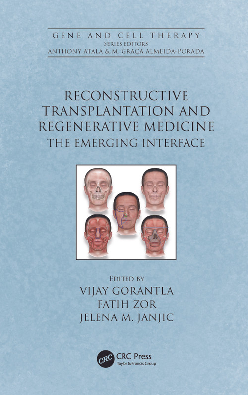 Reconstructive Transplantation and Regenerative Medicine (The Emerging Interface) by Vijay Gorantla, Faith Zor, Jelena M. Janjic, 9781032116761