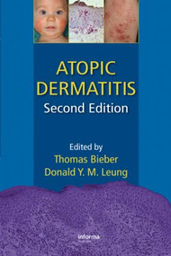 Atopic Dermatitis by Thomas Bieber, Donald Y. M. Leung, 9781420077988