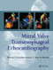 Mitral Valve Transesophageal Echocardiography by Martin G. St. John Sutton, Alan R. Maniet, 9780367446420