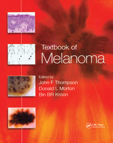 Textbook of Melanoma (Pathology, Diagnosis and Management) by John F. Thompson, Donald L. Morton, Bin B.R. Kroon, 9780367394974