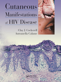 Cutaneous Manifestations of HIV Disease by Clay Cockerell, Antoanella Calame, 9780367452193