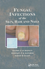 Fungal Infections of the Skin and Nails by Raimo E. Suhonen, Rodney P.R. Dawber, David H. Ellis, 9780367399733