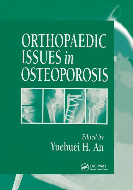 Orthopaedic Issues in Osteoporosis by Yuehuei H. An, 9780367395759