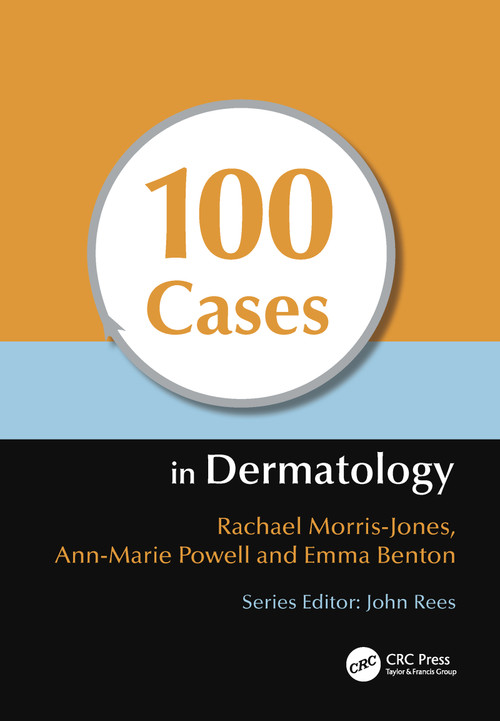 100 Cases in Dermatology by Rachael Morris-Jones, Ann-Marie Powell, Emma Benton, 9781444117936
