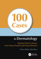 100 Cases in Dermatology by Rachael Morris-Jones, Ann-Marie Powell, Emma Benton, 9781444117936