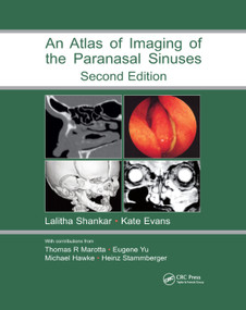 Atlas of Imaging of the Paranasal Sinuses, Second Edition by Lalitha Shankar, Kathryn Evans, 9780367390723