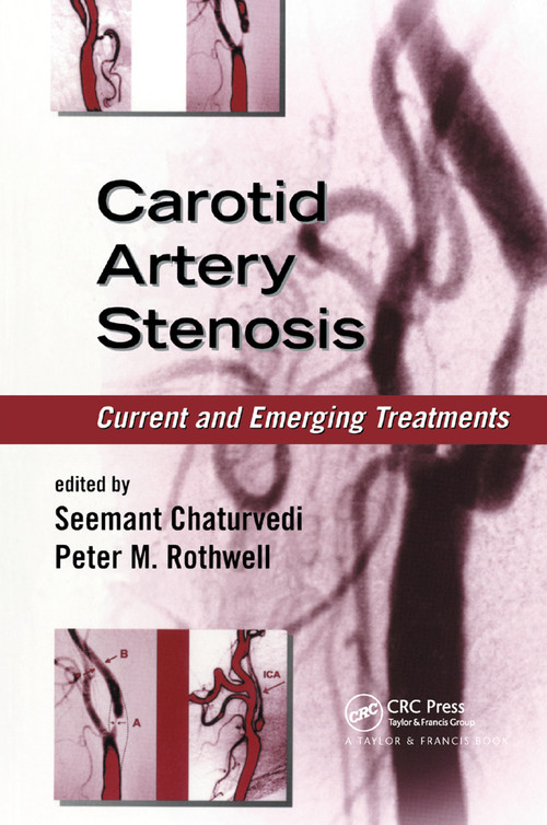 Carotid Artery Stenosis (Current and Emerging Treatments) by Seemant Chaturvedi, Peter M. Rothwell, 9780367392406