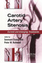 Carotid Artery Stenosis (Current and Emerging Treatments) by Seemant Chaturvedi, Peter M. Rothwell, 9780367392406