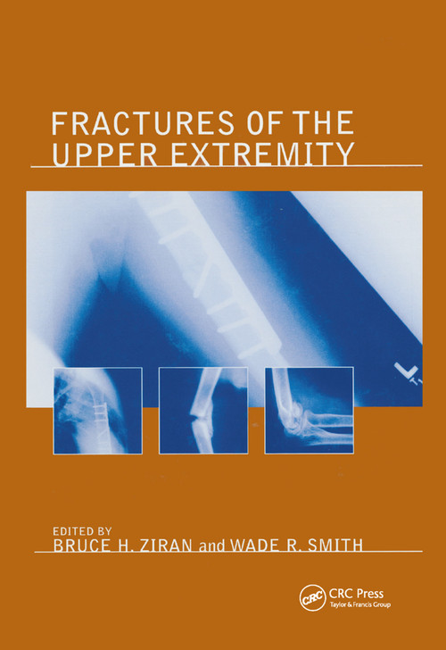 Fractures of the Upper Extremity by Bruce H. Ziran, 9780367394844