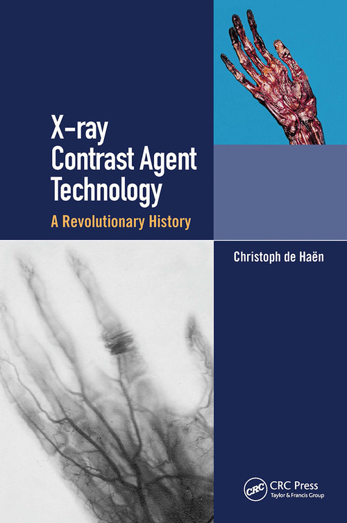 X-ray Contrast Agent Technology (A Revolutionary History) by Christoph de Haen, 9780367730567
