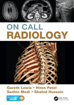 On Call Radiology by Gareth Lewis, Sachin Modi, Hiten Patel, Shahid Hussain, 9781482221671