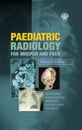 Paediatric Radiology for MRCPCH and FRCR, Second Edition by Christopher Schelvan, Annabel Copeman, Jacqueline Davis, Annmarie Jeanes, Jane Young, 9781853157028